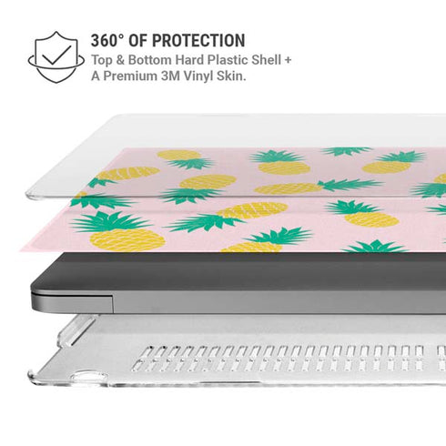 Summer Pineapples MacBook Pro 14in (2021-24) Case plus Skin